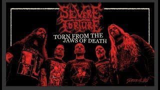 Severe Torture - Torn From The Jaws Of Death (Official)